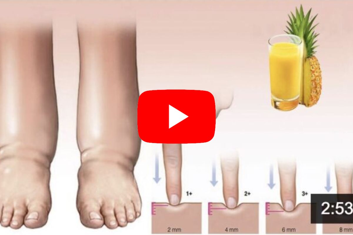 Lymph Relief